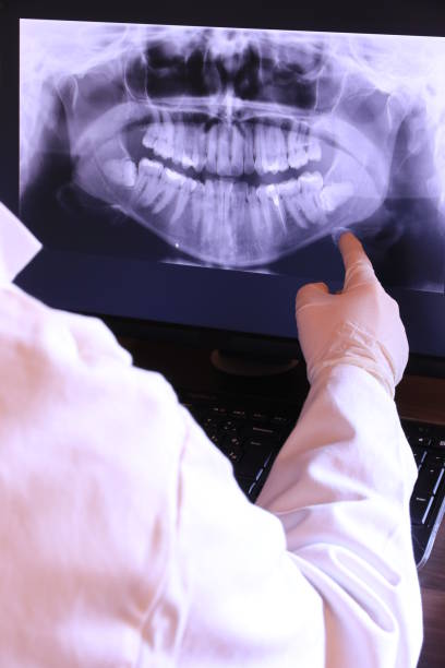 Best Emergency Dental Extractions in Senoia, GA
